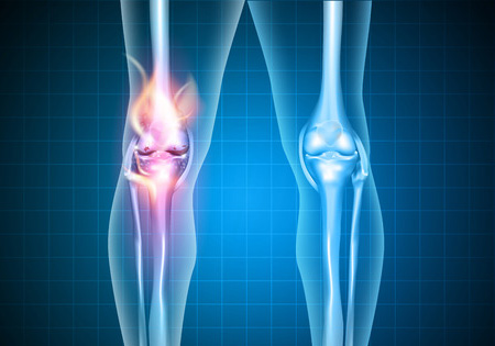fix my knee pain